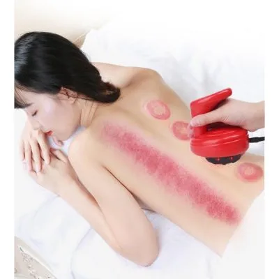 Máy Massage Giác Hơi, Cạo Gió Điện Tử loại rẻ